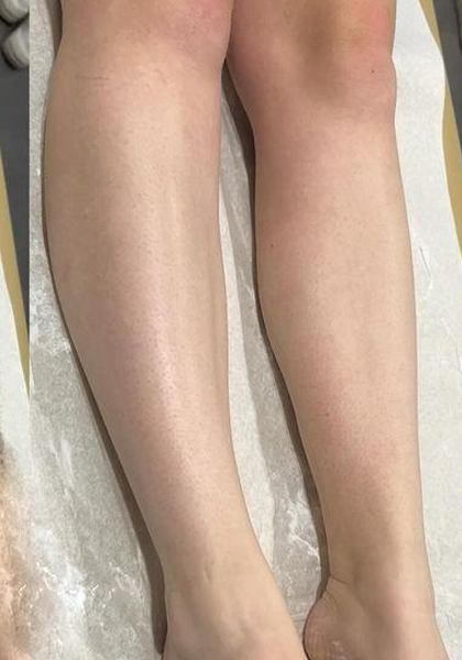 Full Leg